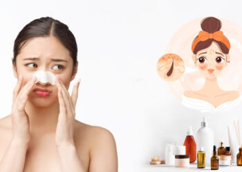 ស្បែកមុខខ្លាញ់អាចនឹងពិបាកក្នុងការថែទាំ.. សូមកុំបារម្ភ សាកល្បងវិធីខាងក្រោមនេះ