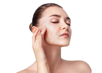 ស្វែងយល់អំពីជំងឺស្បែកស្ងួត ឬ Xerosis … និងដំណោះស្រាយដ៏មានប្រសិទ្ធិភាព!