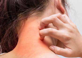 តោះមកស្វែងយល់ពីជំងឺស្បែកដែលឧស្សាហ៏កើតមានអំឡុងពេលរដូវវស្សាទាំងអស់គ្នា!!!