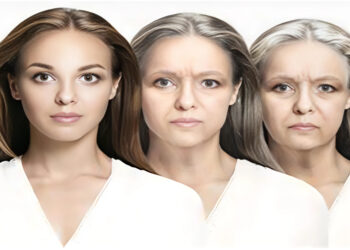 កត្តា5យ៉ាងនាំឲ្យកើតមានស្នាមជ្រួញលើស្បែក