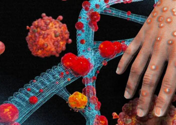 អង្គការសុខភាពពិភពលោក “WHO” បានប្រកាសអាស្ននជាសាកលចំពោះការរីករាតត្បាតជំងឺ Mpox សារជាថ្មី