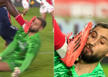 Gianluigi Donnarumma បានរងរបួសបន្ទាប់ពីប៉ះមុខក្នុងជ័យជម្នះរបស់ PSG